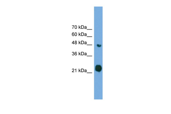 RAB37 Rabbit Polyclonal Antibody