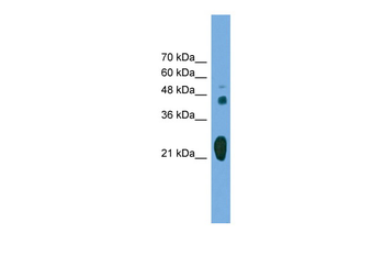 RAB37 Rabbit Polyclonal Antibody
