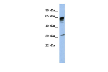 PRR18 Rabbit Polyclonal Antibody