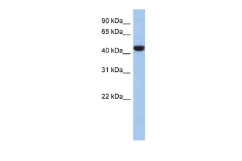 PRR30 Rabbit Polyclonal Antibody