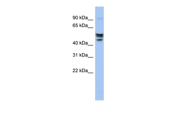 SERINC2 Rabbit Polyclonal Antibody