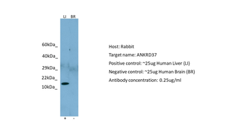 ANKRD37 Rabbit Polyclonal Antibody