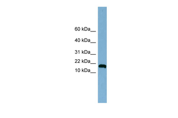 ANKRD37 Rabbit Polyclonal Antibody