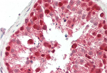 NHLRC2 Rabbit Polyclonal Antibody