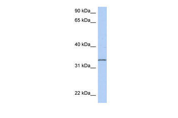 C3orf62 Rabbit Polyclonal Antibody