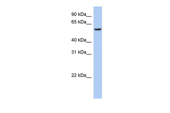 FBXO33 Rabbit Polyclonal Antibody