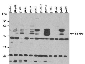 CXorf67 Rabbit Polyclonal Antibody