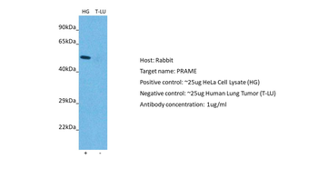 PRAME Rabbit Polyclonal Antibody