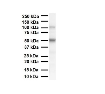 PRAME Rabbit Polyclonal Antibody