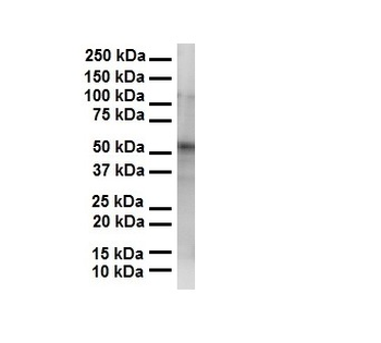 PRAME Rabbit Polyclonal Antibody
