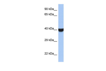 TMED8 Rabbit Polyclonal Antibody