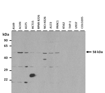 SPNS2 Rabbit Polyclonal Antibody