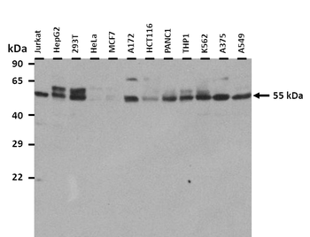PEPD Rabbit Polyclonal Antibody