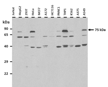 Pros1 Rabbit Polyclonal Antibody