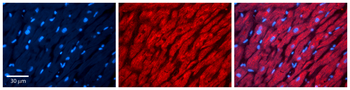 PEX5 Rabbit Polyclonal Antibody