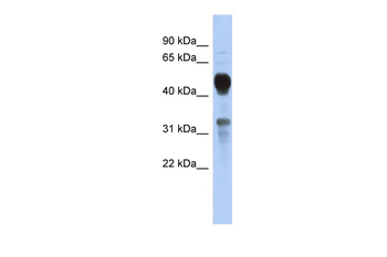 MVK Rabbit Polyclonal Antibody