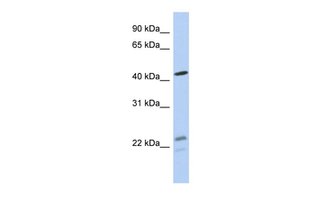 BCKDHA Rabbit Polyclonal Antibody