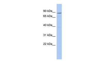 RPS6KA2 Rabbit Polyclonal Antibody
