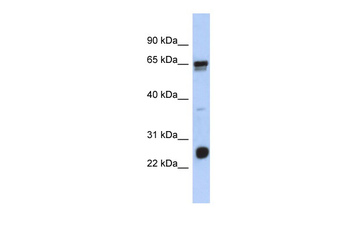 C1orf103 Rabbit Polyclonal Antibody