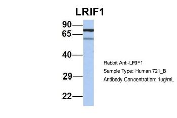 C1orf103 Rabbit Polyclonal Antibody