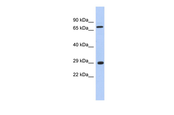 AKTIP Rabbit Polyclonal Antibody