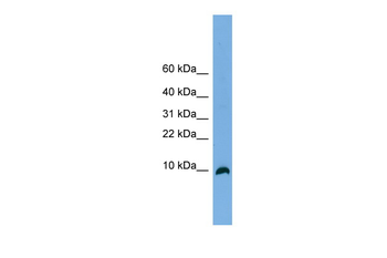 TYMSOS Rabbit Polyclonal Antibody