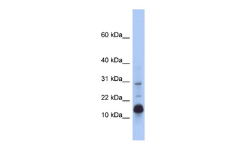 HIST2H2BF Rabbit Polyclonal Antibody