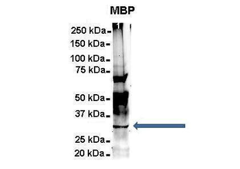 MBP Rabbit Polyclonal Antibody
