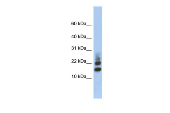 RPS15A Rabbit Polyclonal Antibody