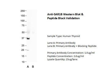SAR1A Rabbit Polyclonal Antibody