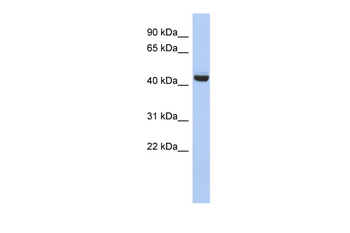 EXOC4 Rabbit Polyclonal Antibody