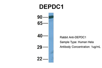 DEPDC1 Rabbit Polyclonal Antibody