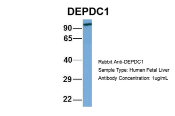 DEPDC1 Rabbit Polyclonal Antibody