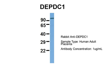 DEPDC1 Rabbit Polyclonal Antibody