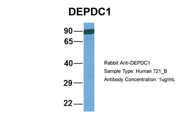 DEPDC1 Rabbit Polyclonal Antibody