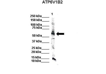 ATP6V1B2 Rabbit Polyclonal Antibody