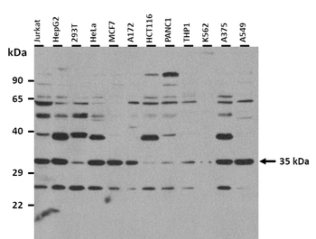 MAGEB2 Rabbit Polyclonal Antibody