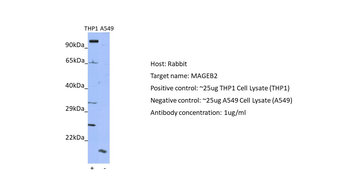 MAGEB2 Rabbit Polyclonal Antibody