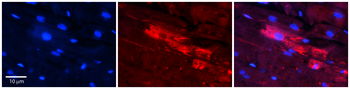 MIF Rabbit Polyclonal Antibody