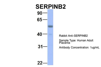 SERPINB2 Rabbit Polyclonal Antibody