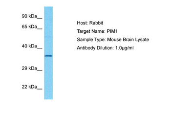 PIM1 Rabbit Polyclonal Antibody