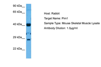 PIM1 Rabbit Polyclonal Antibody