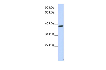 PPP1R7 Rabbit Polyclonal Antibody