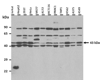 PRKACB Rabbit Polyclonal Antibody
