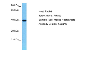 PRKACB Rabbit Polyclonal Antibody
