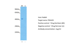 PRKACB Rabbit Polyclonal Antibody