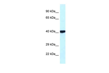 PRKACB Rabbit Polyclonal Antibody