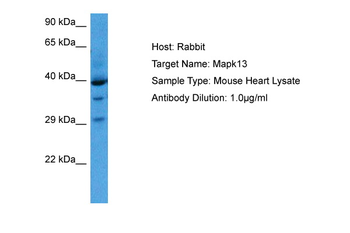 MAPK13 Rabbit Polyclonal Antibody