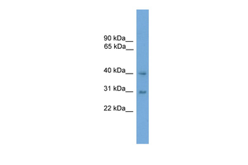 MAPK13 Rabbit Polyclonal Antibody
