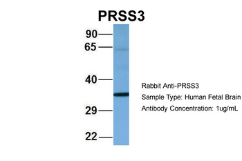 PRSS3 Rabbit Polyclonal Antibody